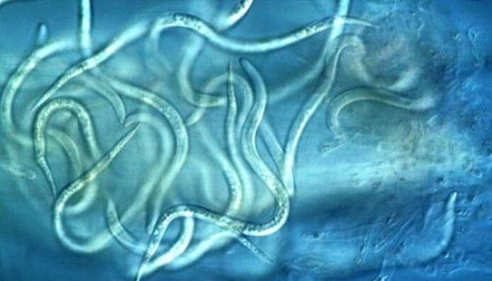 hogy néznek ki a fonálféreg-paraziták az emberi testben