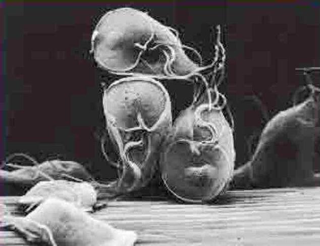 protozoon parazita giardia